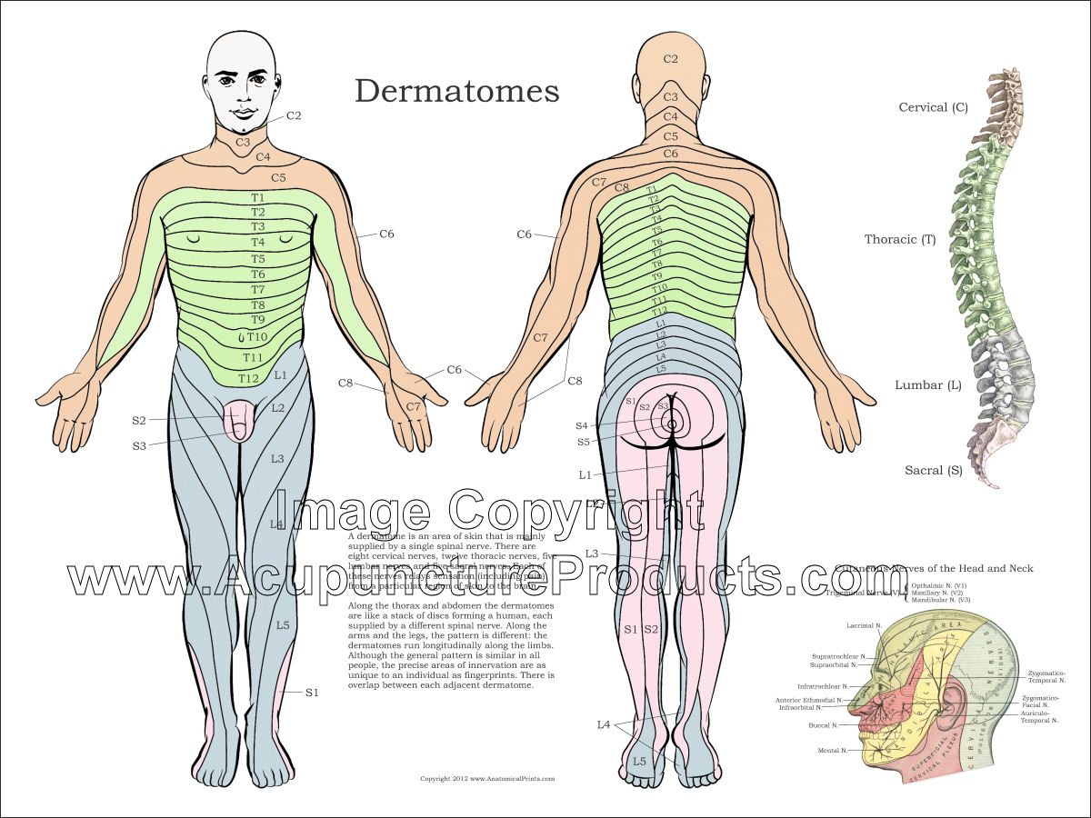 Dermatomal Distribution Pattern Poster